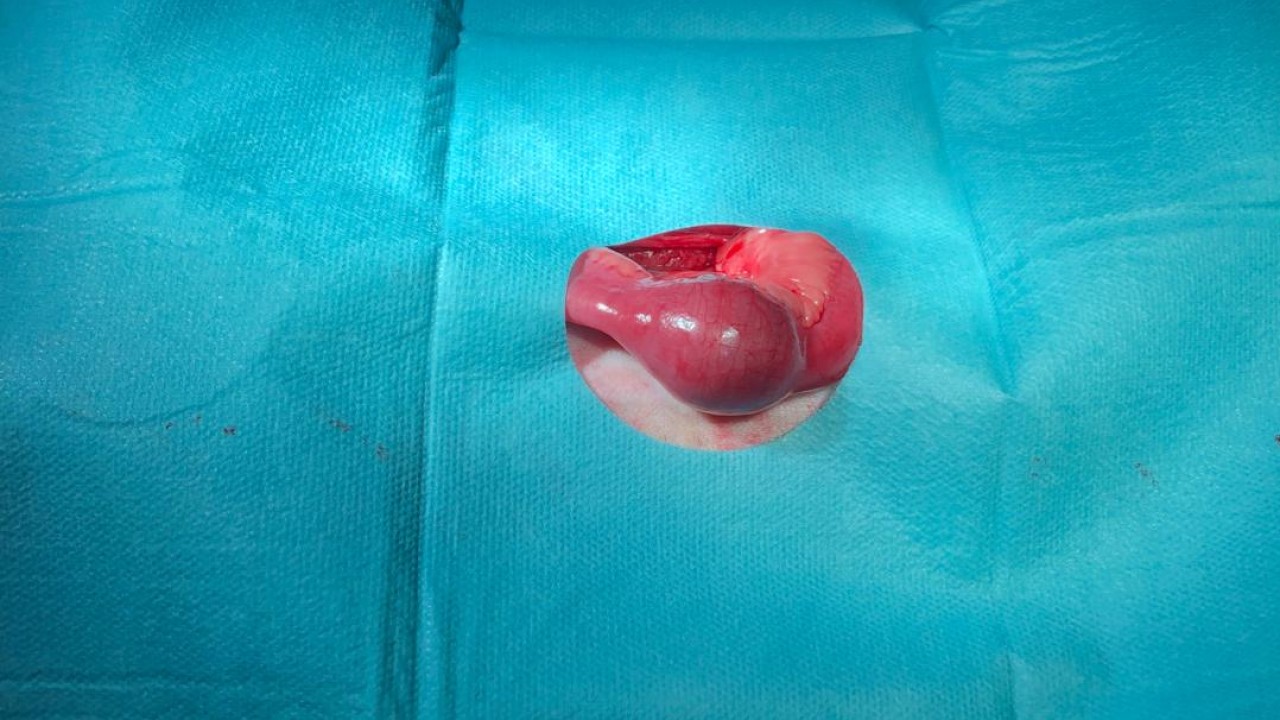 chirurgie digestive